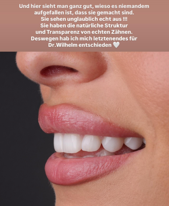 Hava via Instagram Story 3