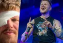 Finch erleidet Augenverletzung bei Auftritt