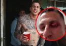 Blutiges Auge – Gzuz erleidet Platzwunde im Gesicht