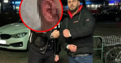 Nach brutalem Angriff mit Machete und Eisenstange – TikToker zeigt Platz- und Stichverletzungen Nach brutalem Angriff mit Machete und Eisenstange – TikToker zeigt Platz- und Stichverletzungen