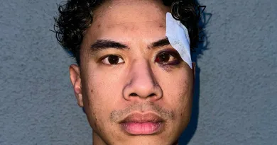 Rassismus-Angriff – Comedian Tutty Tran auf offener Straße zusammengeschlagen Rassismus-Angriff – Comedian Tutty Tran auf offener Straße zusammengeschlagen