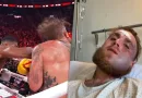 Kieferbruch – Schockbilder von Jake Paul aufgetaucht