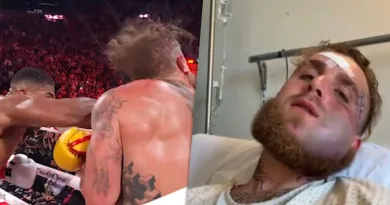 Kieferbruch – Schockbilder von Jake Paul aufgetaucht