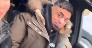 Operation erfolgreich – Die neue Nase von Haftbefehl wurde enthüllt Operation erfolgreich – Die neue Nase von Haftbefehl wurde enthüllt