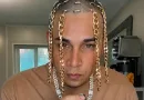 23-Jähriger Rapper hat sich Goldketten als Haare implantieren lassen 23-Jähriger Rapper hat sich Goldketten als Haare implantieren lassen