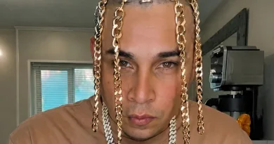 23-Jähriger Rapper hat sich Goldketten als Haare implantieren lassen 23-Jähriger Rapper hat sich Goldketten als Haare implantieren lassen