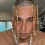 23-Jähriger Rapper hat sich Goldketten als Haare implantieren lassen